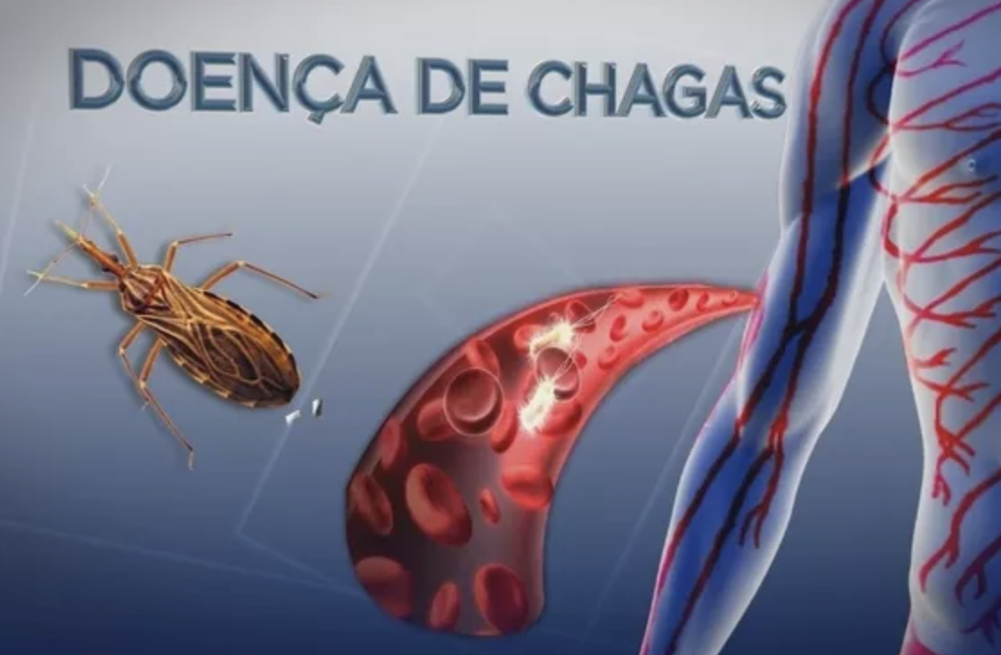 SciELO - Brasil - Diretriz da SBC sobre Diagnóstico e Tratamento de  Pacientes com Cardiomiopatia da Doença de Chagas – 2023 Diretriz da SBC  sobre Diagnóstico e Tratamento de Pacientes com Cardiomiopatia